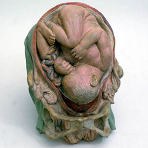 cesarean.jpg.jpg